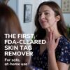Dr. Scholl's Freeze Away Skin Tag Remover - The First FDA Cleared, at Home Skin tag Removal kit. Clinically Proven Skin tag Removal in as Little as 1 Treatment. 1 Skin tag...